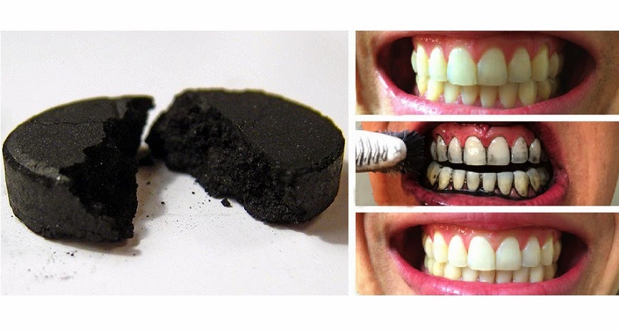 Resultado de imagen para Remedio para eliminar los dientes amarillentos