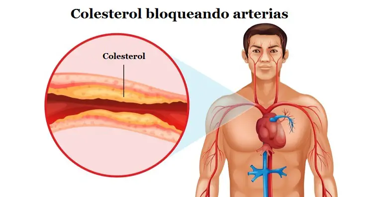 colesterol enfermedades crónicas corazón