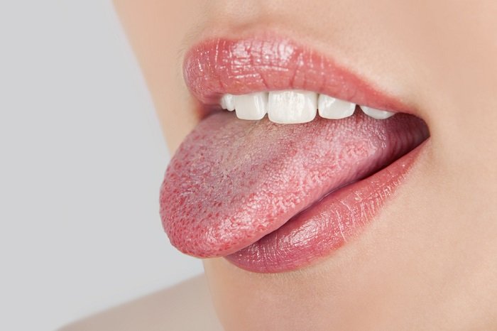 candidiasis bucal presente en la lengua