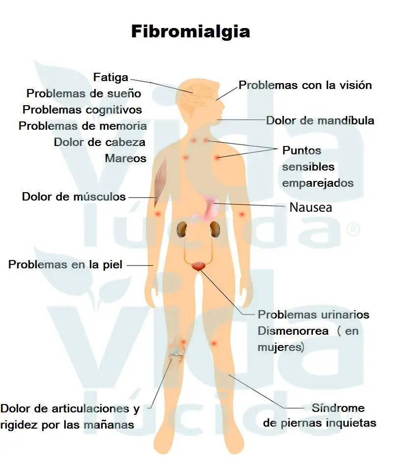 qué es la fibromialgia