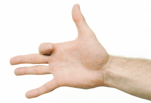 dolor de artritis en las manos doblar