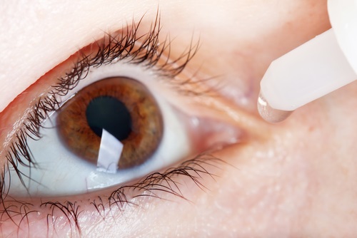 sintomas del síndrome del ojo seco