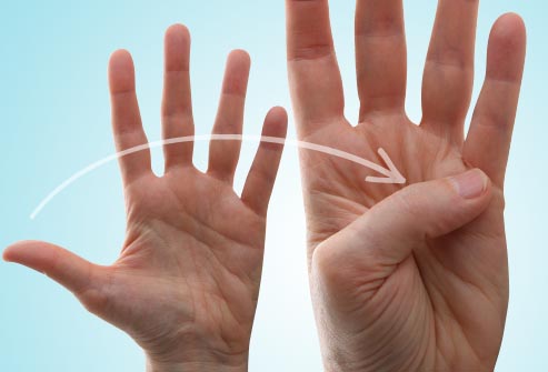 dolor de artritis en las manos alcanzar dedo