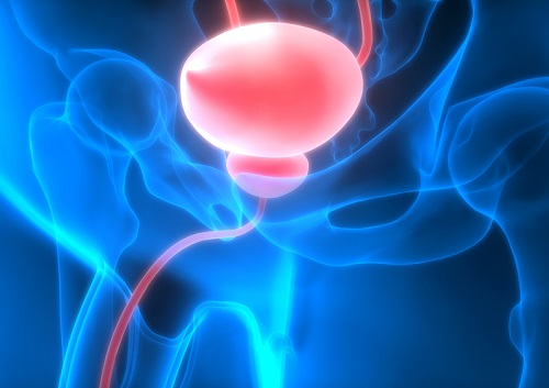 cómo prevenir el cáncer de próstata con los aliemtnos rojos