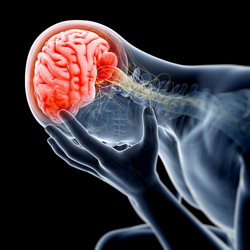 Una imagen ilustrada del padecimiento de la cefalea emocional