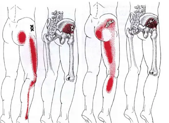 dolor-miofacscial-piernas