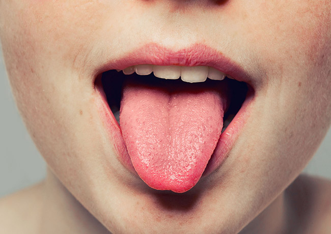 Una chica joven con la lengua sana y sin manchas blancas