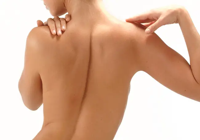 Los músculos de la espalda de una mujer que no lleva sostén