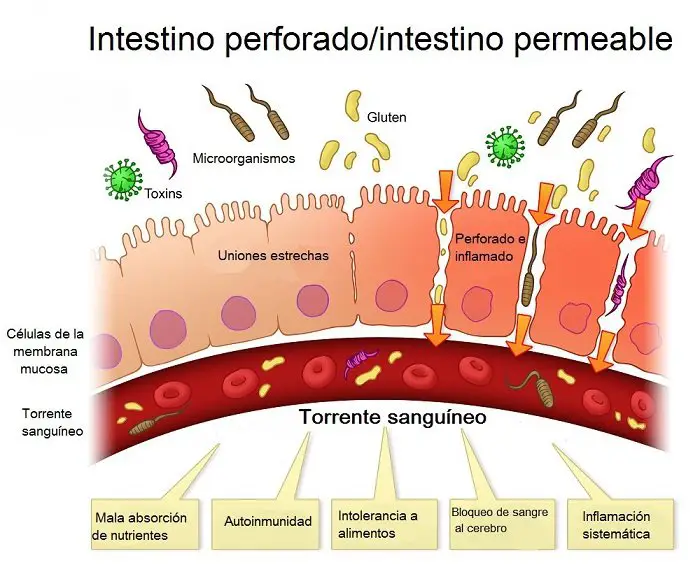 intestino permeable en hipotiroidismo