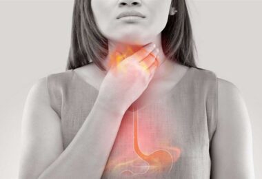 Acidez estomacal por reflujo frecuente y posible causa de cáncer de esófago