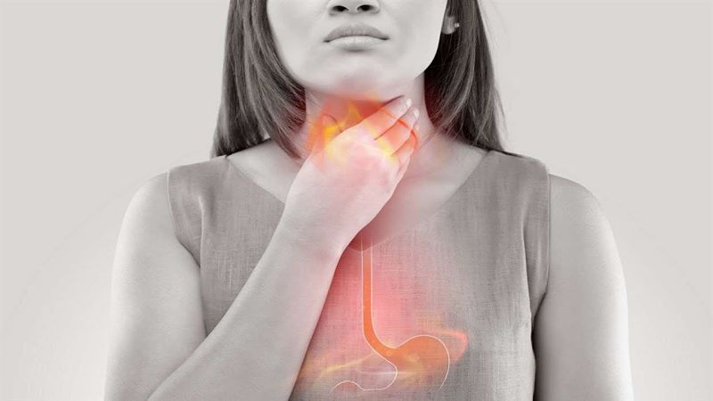 Acidez estomacal por reflujo frecuente y posible causa de cáncer de esófago