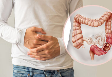 Cáncer de colon