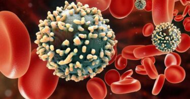 Pepfar contra el sida