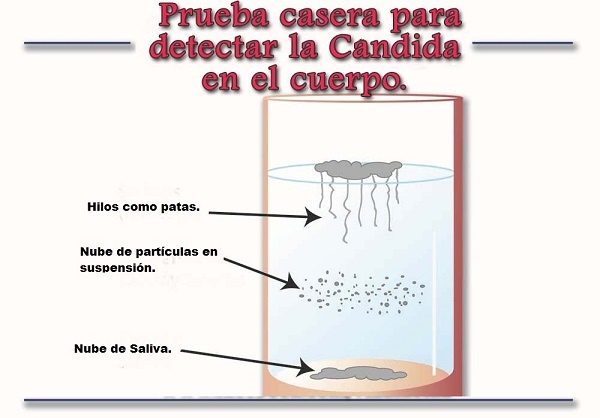 Prueba-casera-para-detectar-la-c-C3-A1ndida-en-el-cuerpoff