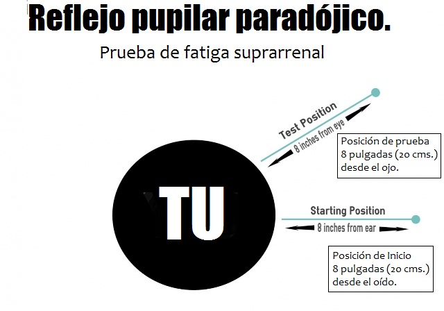 Reflejo pupilar paradójico