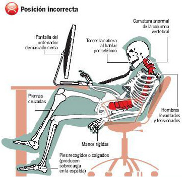 Postura incorrecta frente al monitor