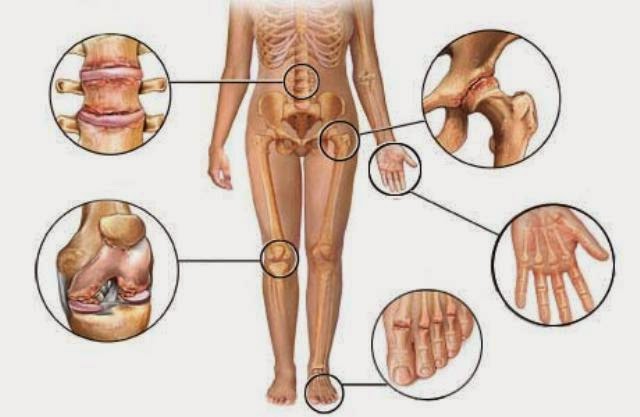 dolor articular