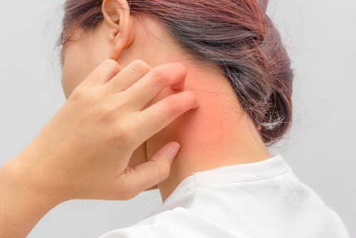 alergia a determinados alimentos