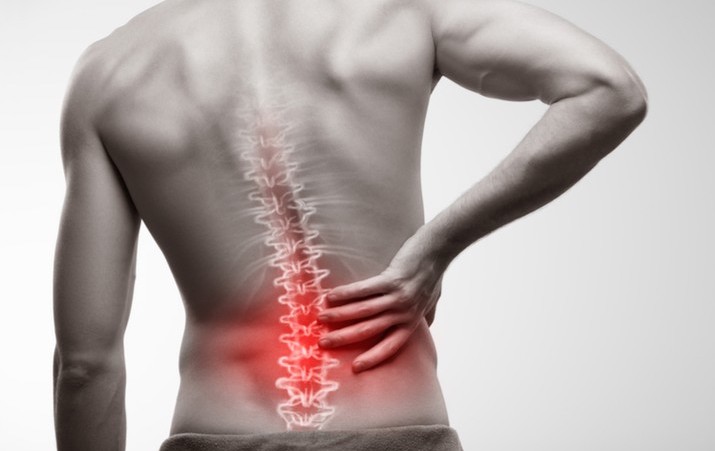 hernia discal y sus causas