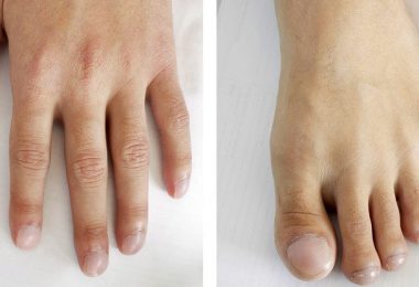 Las advertencias que pueden darte tus uñas