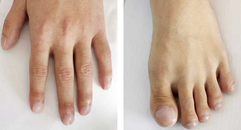 Las advertencias que pueden darte tus uñas