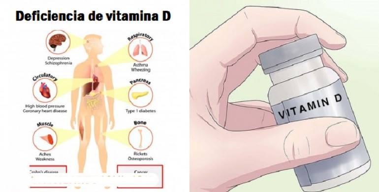 La falta de vitamina d adelgaza