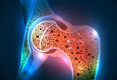 Signos de que padeces osteoporosis
