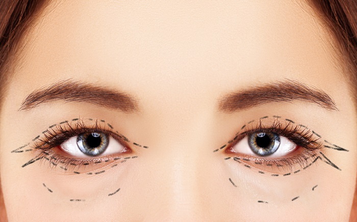 ojos hinchados bolsas debajo de los ojos