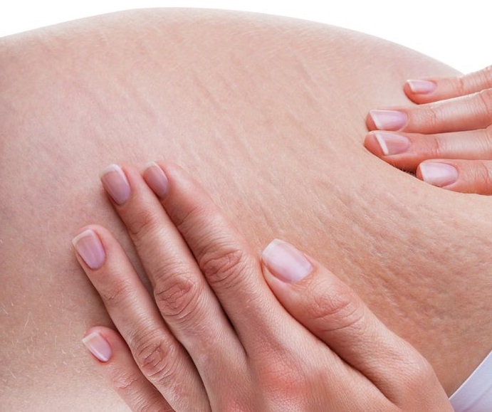 celulitis