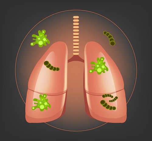 Pulmones1