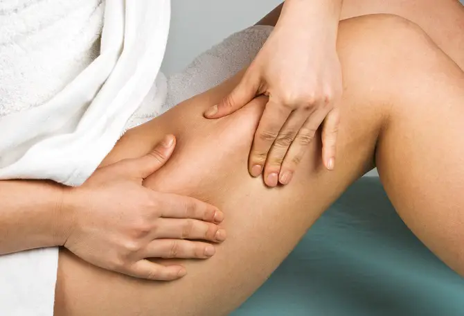 celulitis