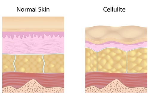 frutas para combatir la celulitis