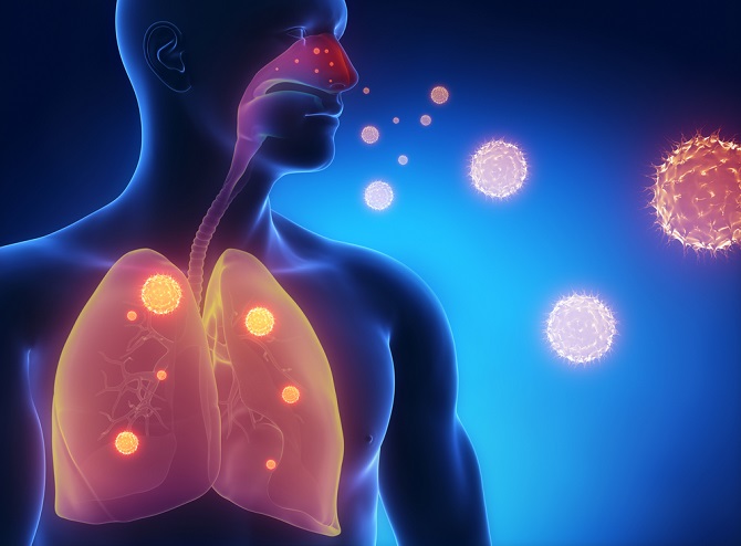 Gráfico que demuestra el cuerpo humano y los pulmones ante la presencia de SIDA