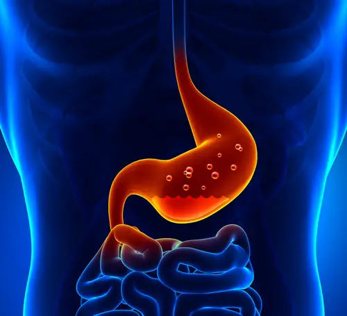 causas de la gastritis nerviosa