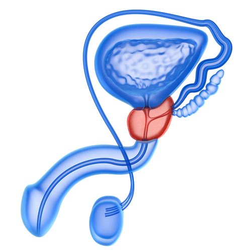 signos cáncer de próstata