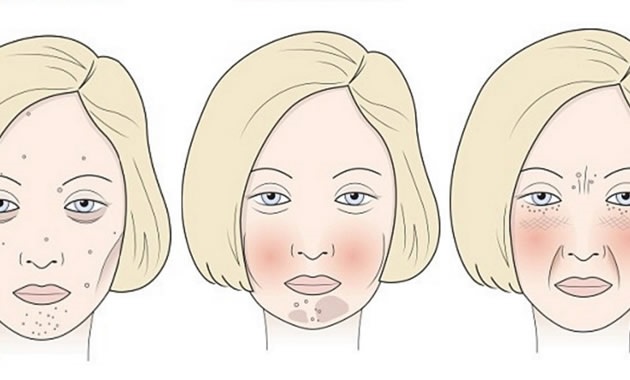 Azúcar, leche y gluten pueden afectar la apariencia del rostro
