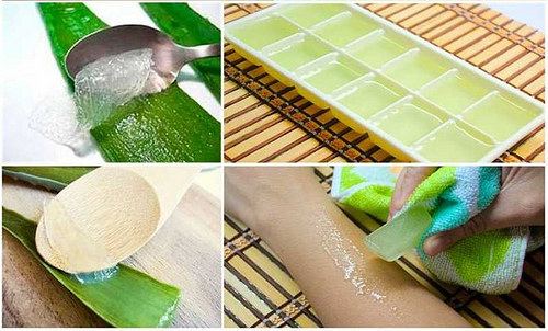 cómo aplicar aloe vera para tratamientos