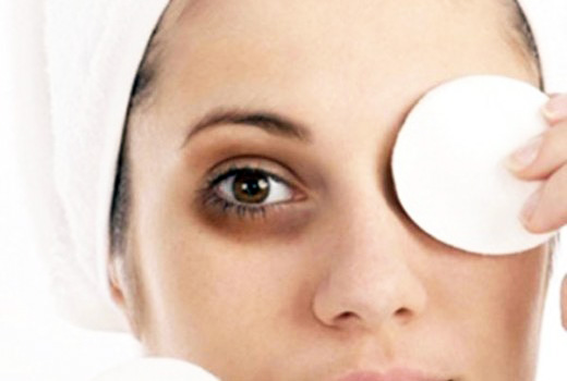 círculos oscuros debajo de los ojos