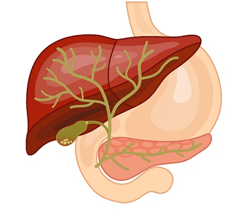 cálculos biliares producen dolor abdominal