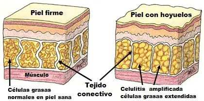 bebida secreta para disminuir la celulitis