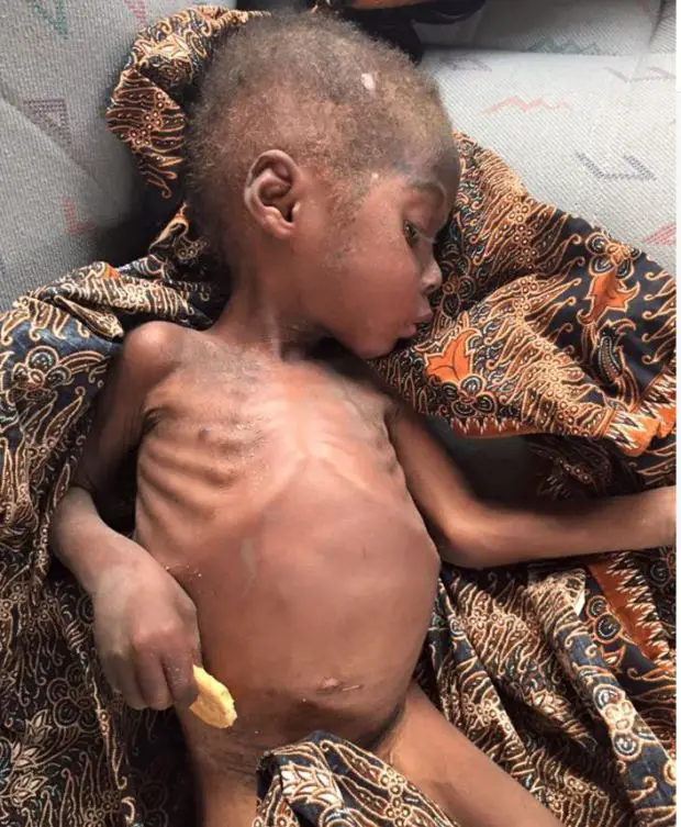 rescate de niño de dos años africano