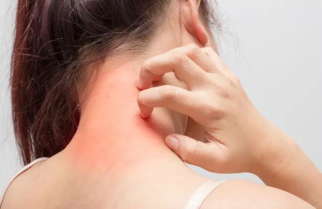 Las preguntas que debes realizar al dermatólogo
