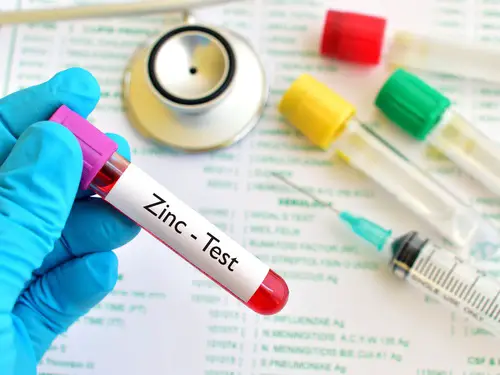 análisis de sangre zinc para función tiroidea