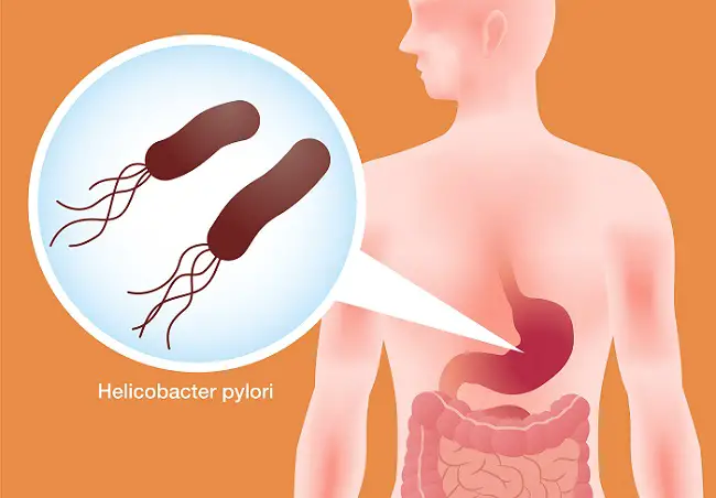 Helicobacter pylori