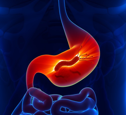 Padecimientos de Helicobacter pylori