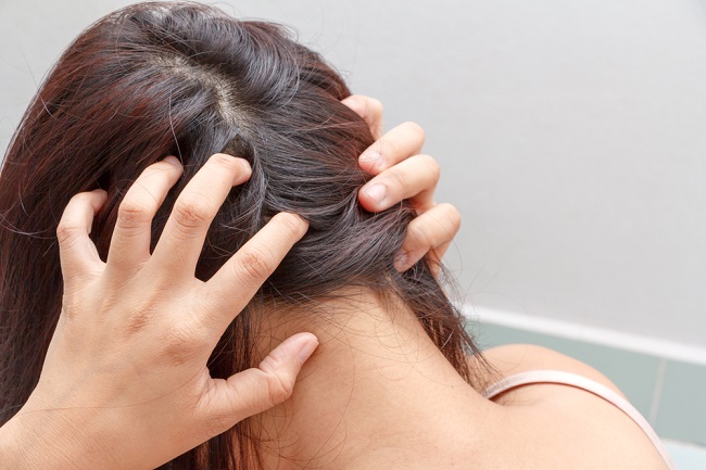 dermatitis-seborreica-3
