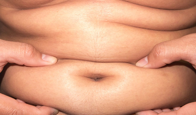 Acumulación de grasa abdominal por desequilibrio hormonal