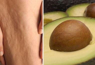 piel con celulitis y semillas de aguacate para tratarla