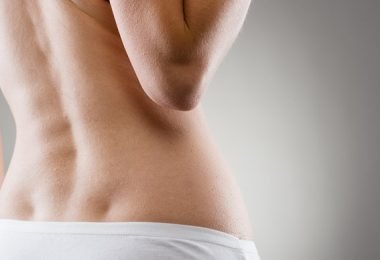 Mujer con escoleosis en la espalda