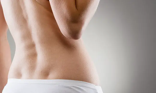 Mujer con escoleosis en la espalda